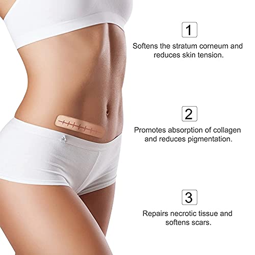 Silicone Scar Sheets (1.6 x 120 Inch), Medical Grade Silicone Scar Tape,Scar ...