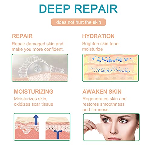 Silicone Scar Sheets (1.6 x 120 Inch), Medical Grade Silicone Scar Tape,Scar ...