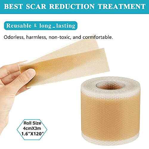 Silicone Scar Sheets (1.6 x 120 Inch), Medical Grade Silicone Scar Tape,Scar ...
