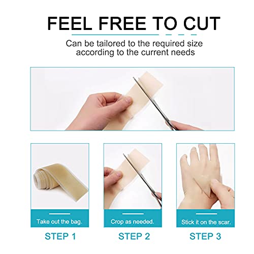 Silicone Scar Sheets (1.6 x 120 Inch), Medical Grade Silicone Scar Tape,Scar ...