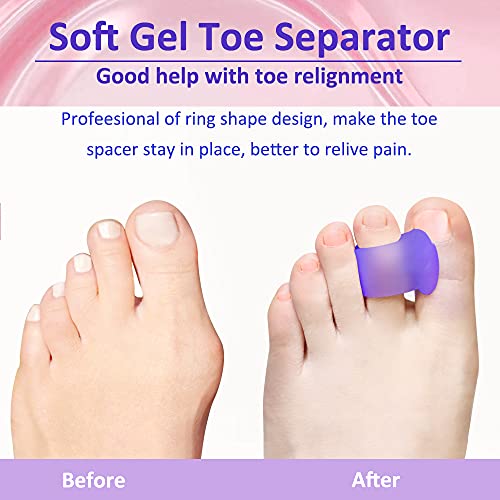 Pesalmon 12Pack Gel Toe Separators for Overlapping Toes, Bunion Corrector and...