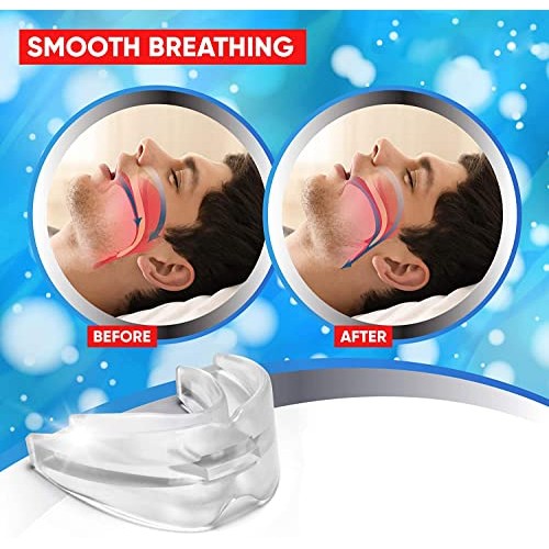 Mouth Guards for Teeth Grinding, Custom Fit Night Dental Guard with Case for ...