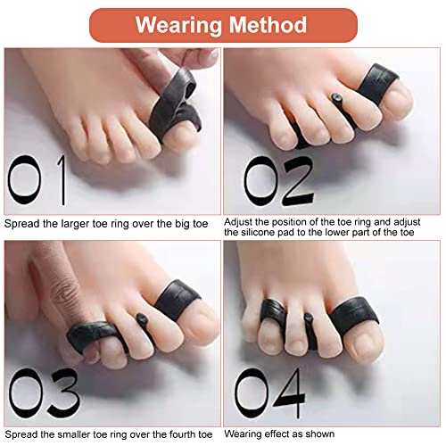 Toe Separator,Toe Spacers,Toe Straightener,Toe Spreaders to Correct Bunions a...