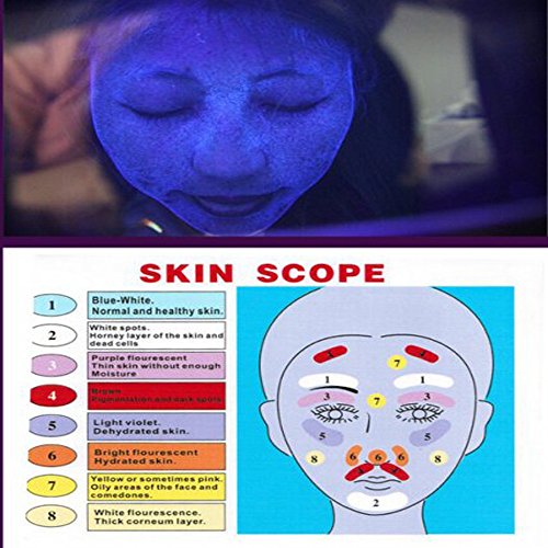 Pevor Exam Skin UV Magnifying Analyzer Wood Lamp Skin Test Skin Detection Bea...