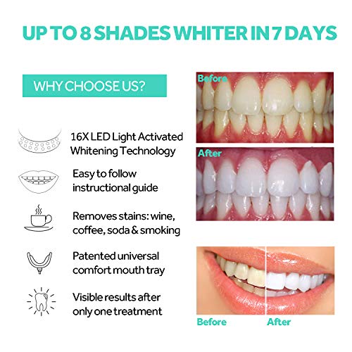Teeth Whitening Accelerator Light, 16x More Powerful Blue LED Light, Mouth Tr...