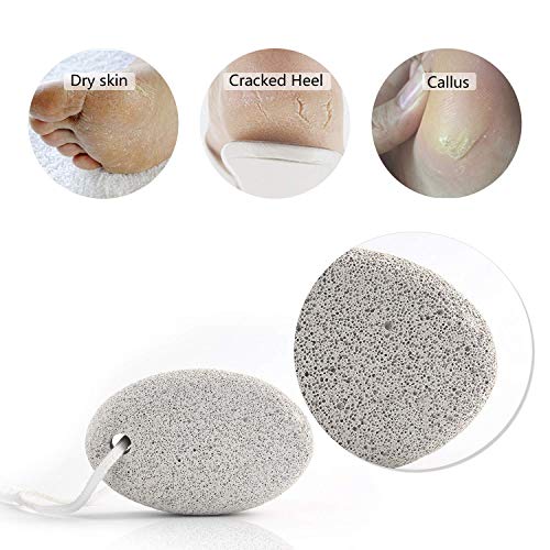 Natural Pumice Stone for Feet 2 PCS, PHOGARY Lava Pedicure Tools Hard Skin Ca...