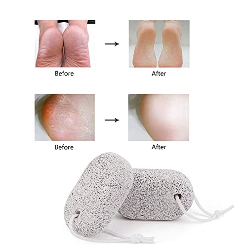 Natural Pumice Stone for Feet 3 PCS, PHOGARY Lava Pedicure Tools Hard Skin Ca...