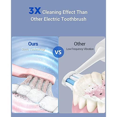 Sonic Electric Toothbrush for Aduts and Kids - High Power Rechargeable Toothb...