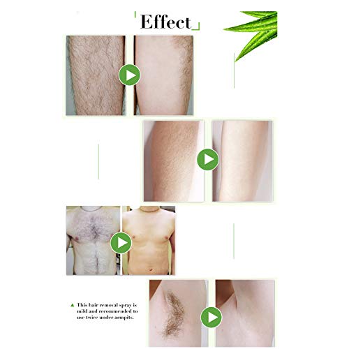 Hair Removal Spray, Gentle Painless Hair Stop Spray, Permanent Hair Removal S...