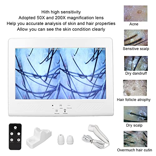 Skin Diagnosis Hair Analyzer, 12 Inch LCD Screen Scalp Hair Follicle Hair Ski...