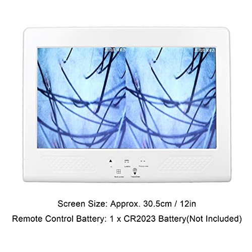 Skin Diagnosis Hair Analyzer, 12 Inch LCD Screen Scalp Hair Follicle Hair Ski...