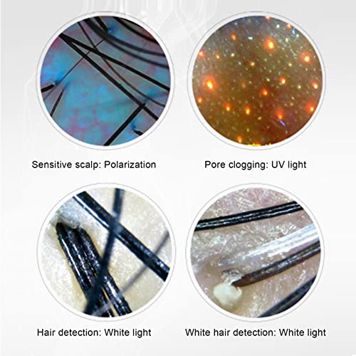 Skin Diagnosis Hair Analyzer, 12 Inch LCD Screen Scalp Hair Follicle Hair Ski...