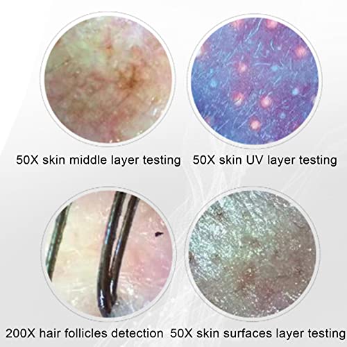Skin Diagnosis Hair Analyzer, 12 Inch LCD Screen Scalp Hair Follicle Hair Ski...