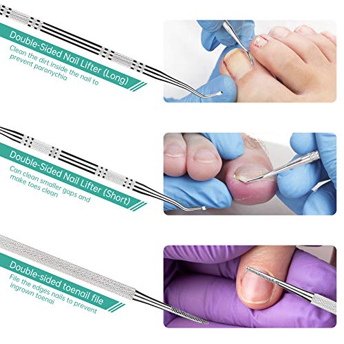 3-Pack Ingrown Toenail File And Lifters, 100% Professional Surgical Stainless...