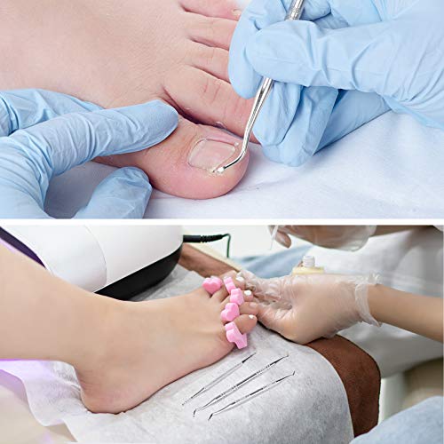 3-Pack Ingrown Toenail File And Lifters, 100% Professional Surgical Stainless...
