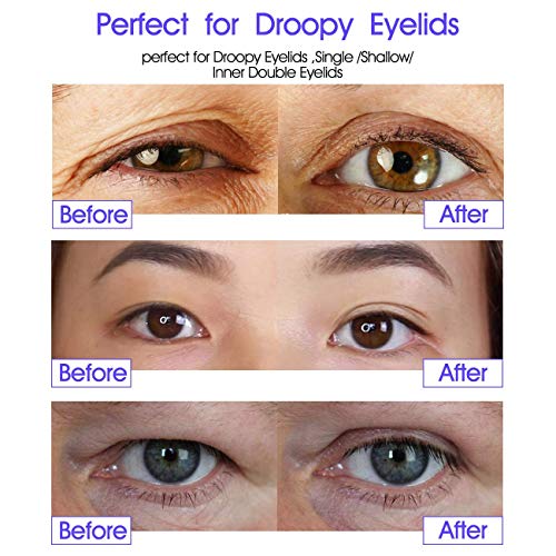Especially Fit for Droopy/Hooded Eyelids Lift Instantly Without Surgery, Larg...