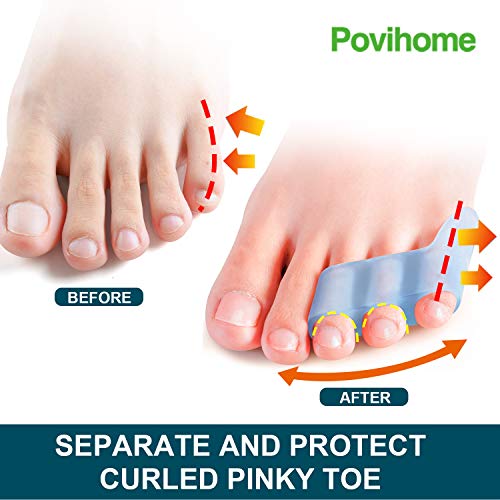 Povihome 10 Pack Pinky Toe Separator and Protectors, Toe Separators for Overl...