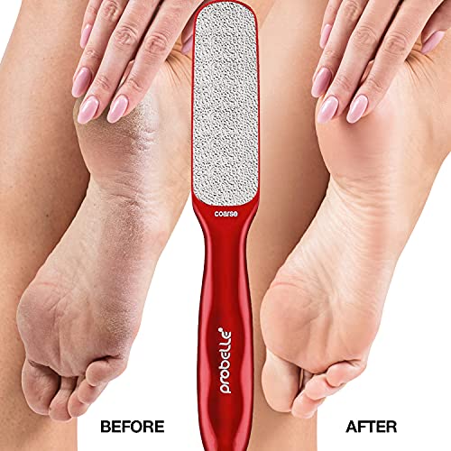 Probelle Double Sided Multidirectional Nickel Foot File Callus Remover - Imme...