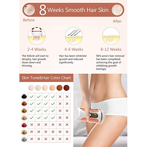At Home Laser Hair Removal Permanent for Women and Men - ProCIV IPL Hair Remo...