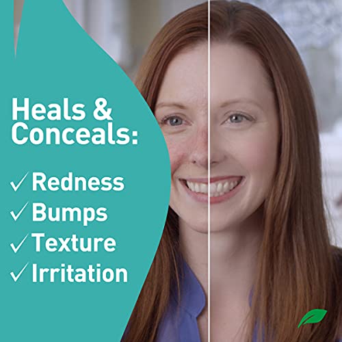 PROcure Rosacare Medicated Redness Reduction CC Face Cream, Hyaluronic Hydrog...