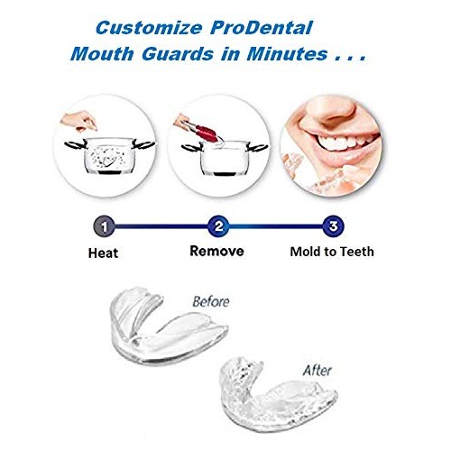 ProDental Thin and Trim Mouth Guard for Grinding Teeth – 3 Pack, Made in USA ...