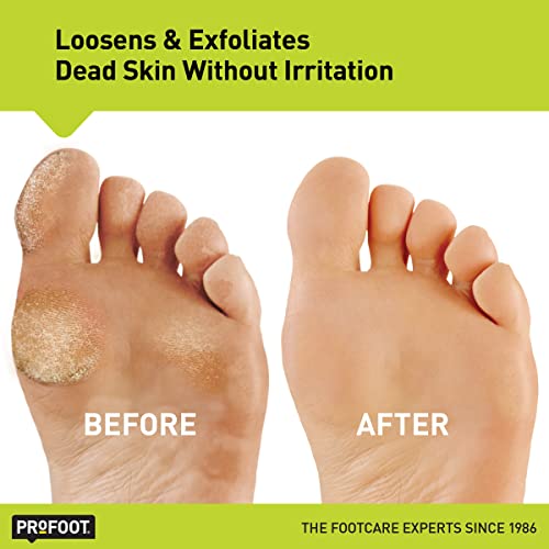 PROFOOT Heel Rescue Callus Blaster Exfoliating Gel, 3 Ounce