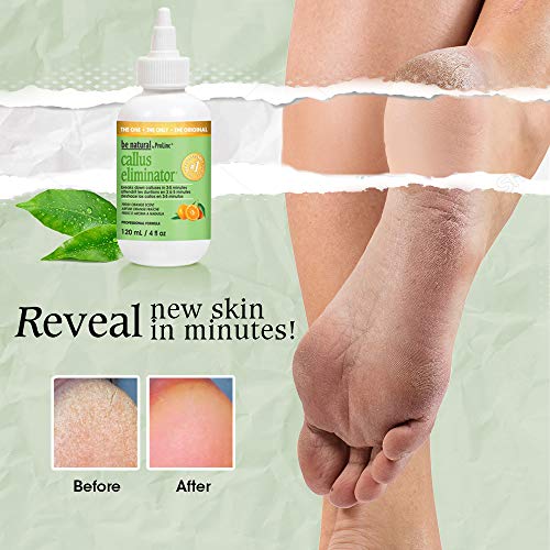 Callus Eliminator orange scent 4oz