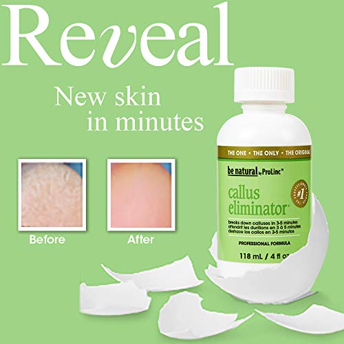 ProLinc Fast Acting Callus Eliminator, 4 oz