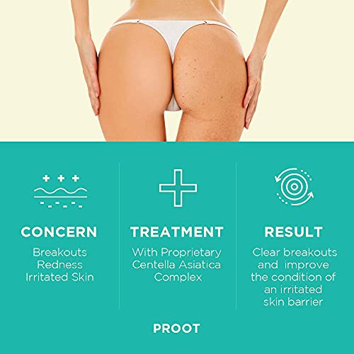 Butt Acne Clearing Spot Treatment Cream. Clears Acne, Pimples, Ingrown Hairs,...