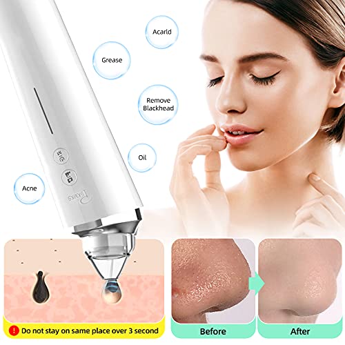 PSKMKS Blackhead Remover Vacuum with Camera 2021 Upgraded 5.0 MP Visual Facia...