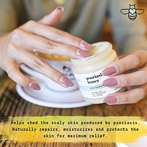 Psoriasis Honey Skin Renewing Cream for Intense Moisturizing - Relieves Dry, ...