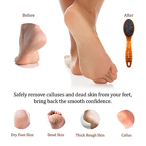 Pumice Stone for Feet & Foot Brush with Handle 2-in-1 Pedicure Scrubber for S...