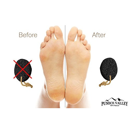 Pumice Stone - Natural Earth Lava Pumice Stone Black - Callus Remover for Fee...