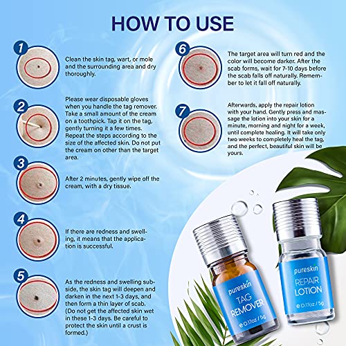 Pureskin Skin Tag Remover & Mole Corrector And Repair Lotion Set, Remove Tags...