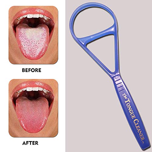 Tongue Scraper Cleaner - the Tongue Cleaner - End Bad Breath and Freshens Bre...