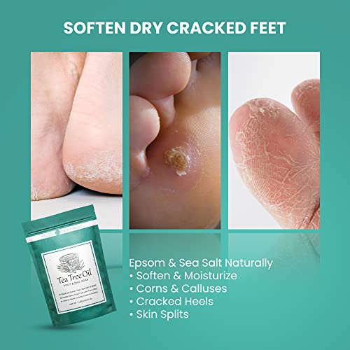 2 in 1 Tea Tree & Oregano Nail Care Kit-Excellent for Discolored, Thick, Crac...