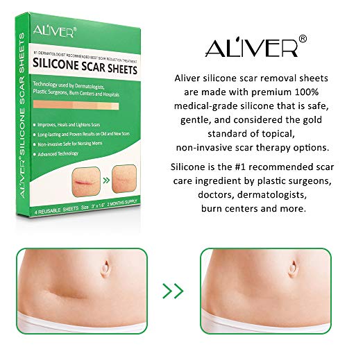 Silicone Scar Removal Sheets, Professional Gel Strips for Scars Caused by C-S...