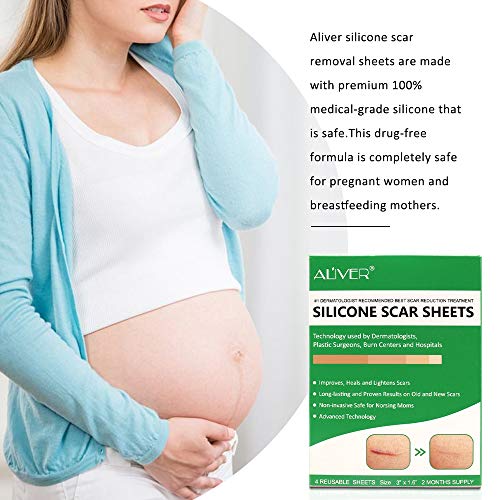 Silicone Scar Removal Sheets, Professional Gel Strips for Scars Caused by C-S...