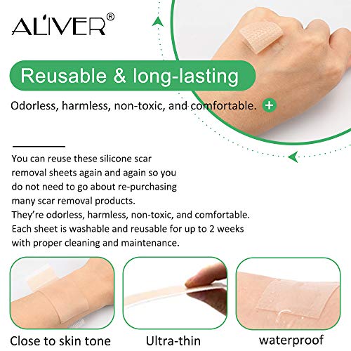 Silicone Scar Removal Sheets, Professional Gel Strips for Scars Caused by C-S...