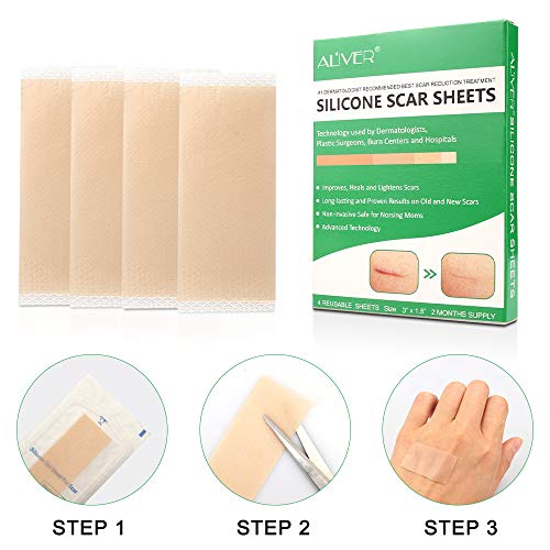 Silicone Scar Removal Sheets, Professional Gel Strips for Scars Caused by C-S...