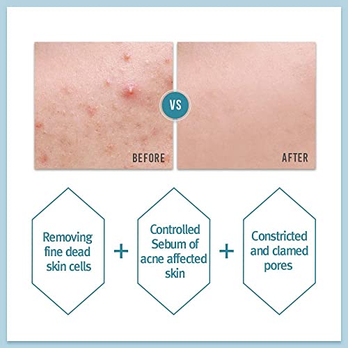 PYUNKANG YUL Acne Toner - Acne Treatment - Salicylic acid BHA Astringent for ...