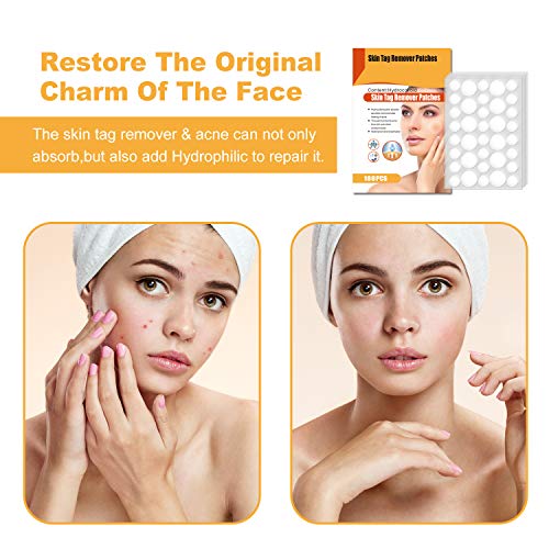 Skin Tag Remover Patches 180PCS, Acne Tag Mole Remover, Wart, Dark Spot, Blem...