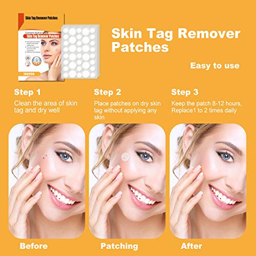 Skin Tag Remover Patches 180PCS, Acne Tag Mole Remover, Wart, Dark Spot, Blem...