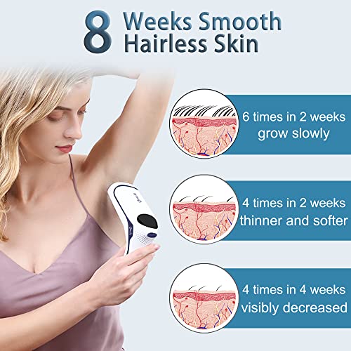 Qmele IPL Hair Removal for Women and Men Permanent Hair Remover with Ice Cool...