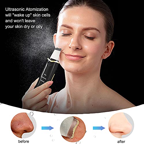 Qukot Ultrasonic Skin Scrubber Spatula - Upgraded Blue-Light Blackhead Remove...