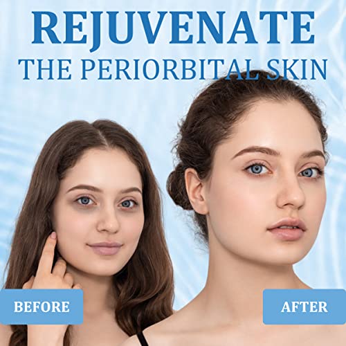 Under Eye Patches, R.A.V Hyaluronic Acid Eye Mask, Collagen Eye Pads for Dark...