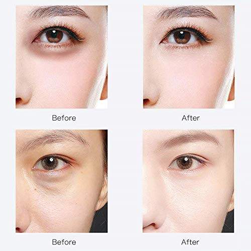 Under Eye Patches,30 pairs Hyaluronic Acid Anti-Aging Under Eye Mask, RABIOTA...