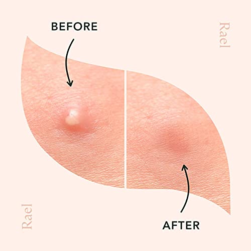 Rael Miracle Invisible Spot Cover - Hydrocolloid, Acne Pimple Absorbing Cover...