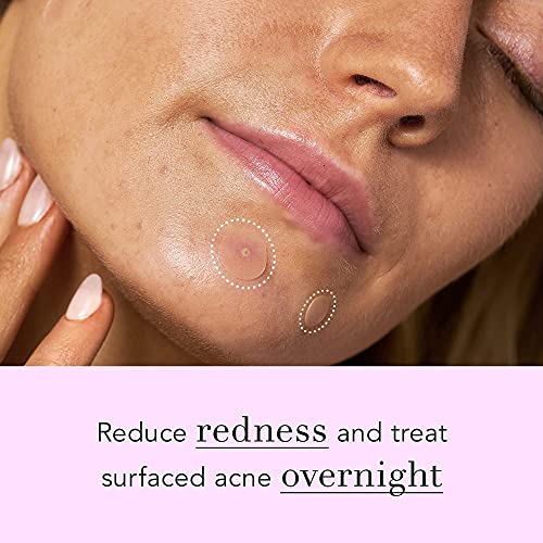 Rael Miracle Overnight Spot Cover - Thicker & Extra Adhesion, Hydrocolloid Ac...