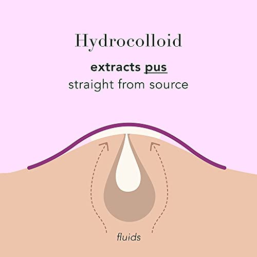 Rael Miracle Overnight Spot Cover - Thicker & Extra Adhesion, Hydrocolloid Ac...